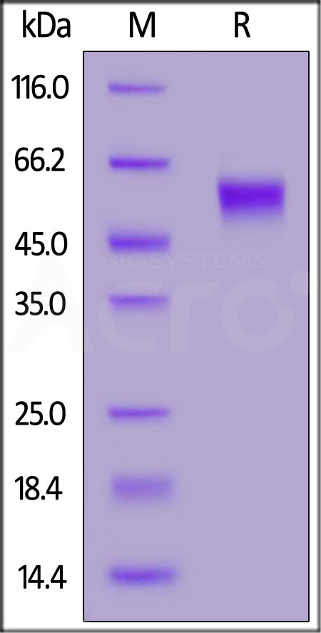 FITC-Labeled Human IL-3 R alpha, His Tag (Cat. No. ILA-HF2H9) SDS-PAGE gel