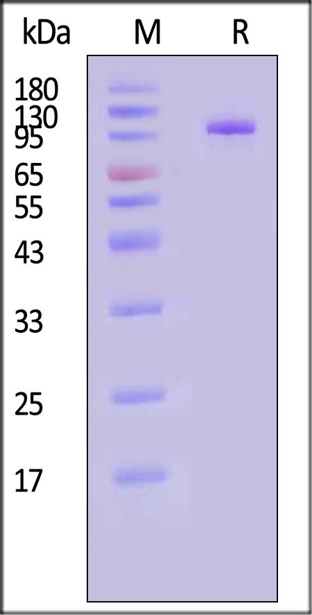 IL-12 R beta 1 SDS-PAGE