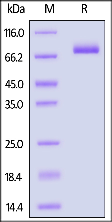 IL-12 R beta 1 SDS-PAGE