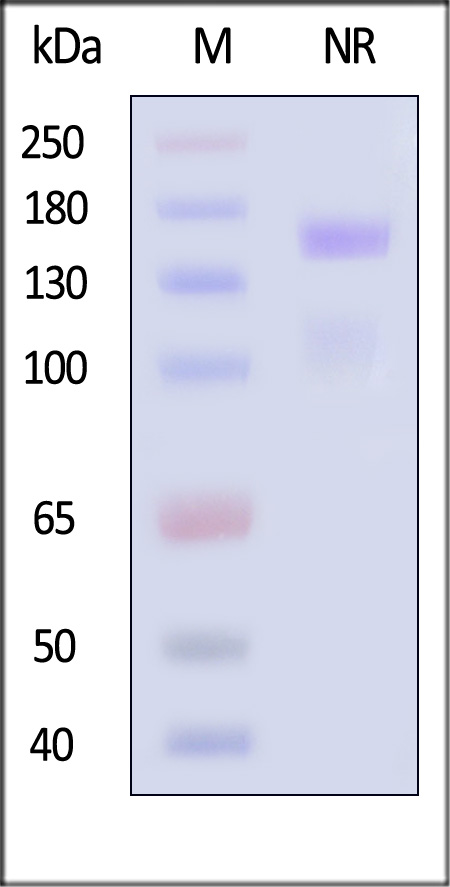 Human ITGA8&ITGB1 Heterodimer Protein, His Tag&Tag Free (Cat. No. IT1-H52W9) SDS-PAGE gel