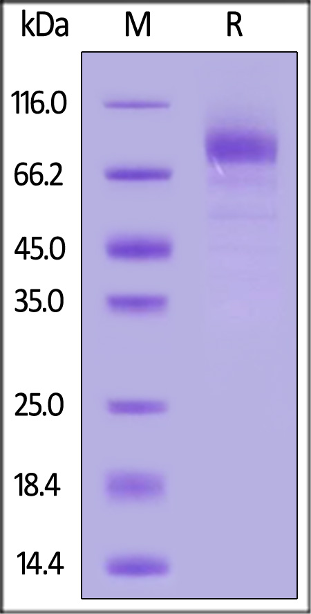 Human LGR4, His Tag (Cat. No. LG4-H52H3) SDS-PAGE gel