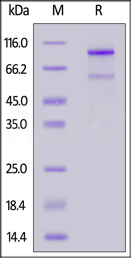 Human LOXL2, His Tag (Cat. No. LO2-H52H3) SDS-PAGE gel