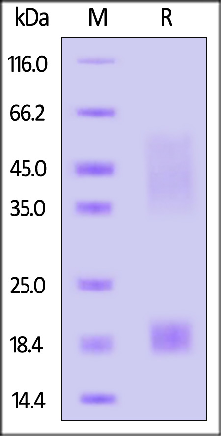 LYPD1 SDS-PAGE