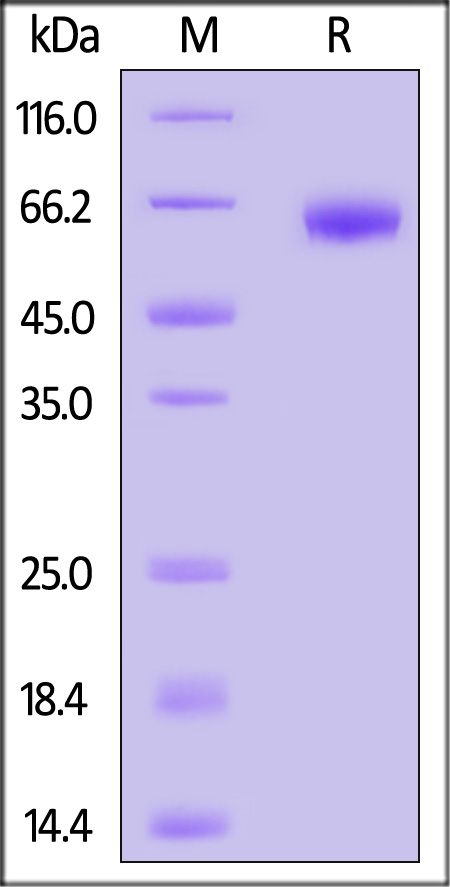 MMP-9 SDS-PAGE