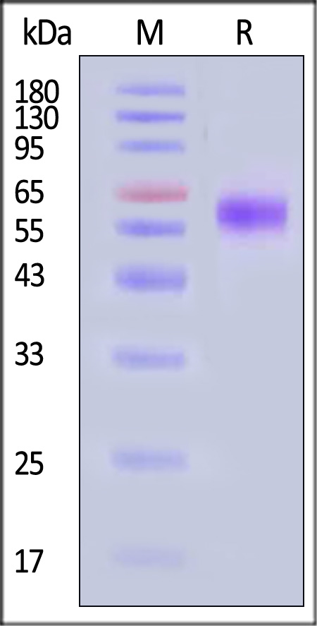 Neuraminidase (NA) SDS-PAGE