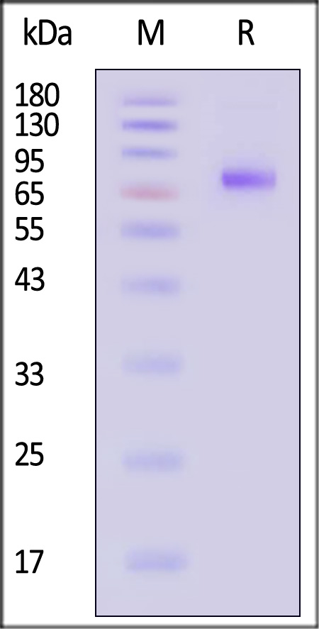 Neuraminidase (NA) SDS-PAGE