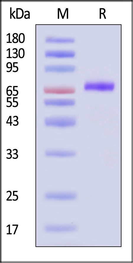 Neuraminidase (NA) SDS-PAGE