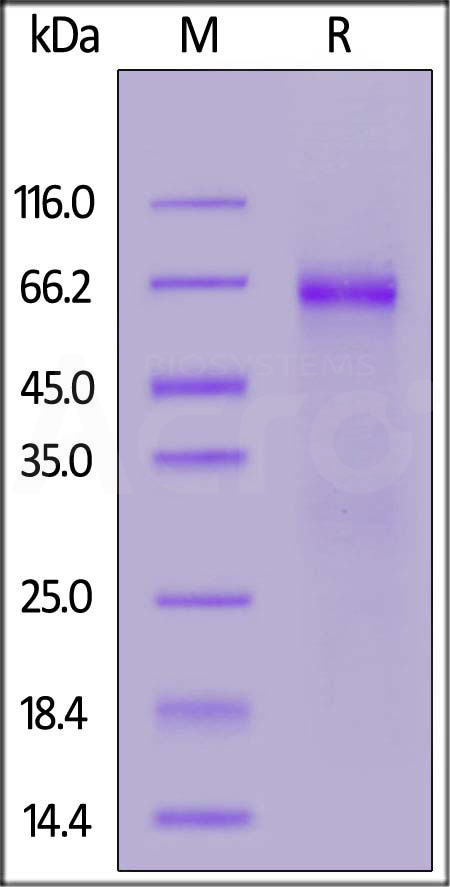 Nucleocapsid protein SDS-PAGE