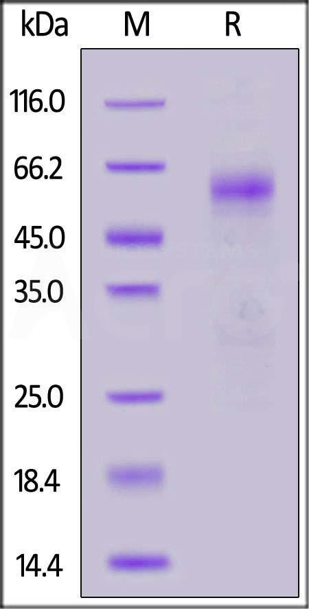 Nucleocapsid protein SDS-PAGE