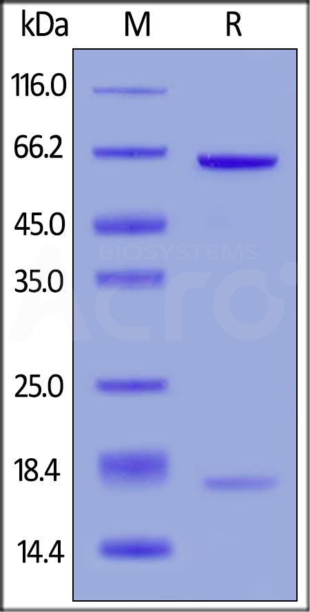 PCSK9 SDS-PAGE