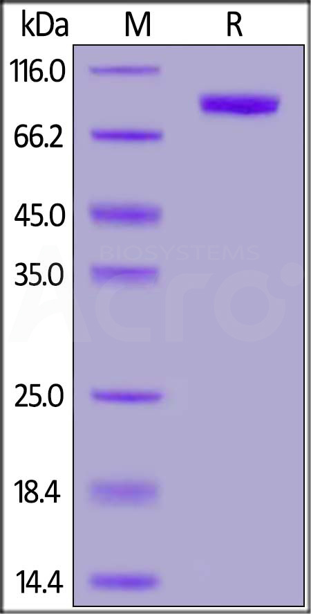 Human pIgR, His Tag (Cat. No. PIR-H5222) SDS-PAGE gel