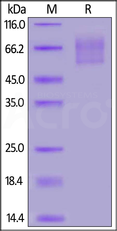 Human PSGL-1, His Tag (Cat. No. PS1-H52H9) SDS-PAGE gel