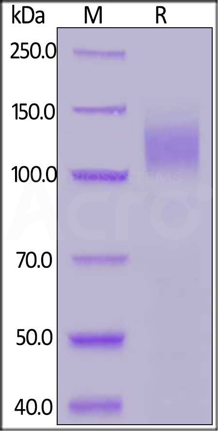 Spike S1 SDS-PAGE