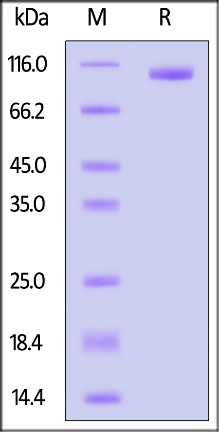 SLITRK6 SDS-PAGE