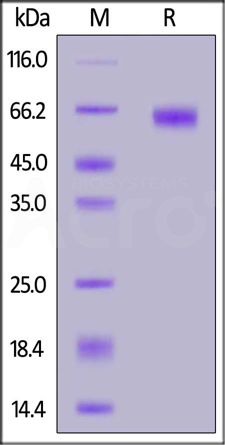 TPBG SDS-PAGE