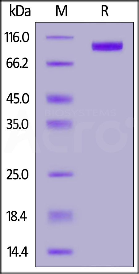 UBE1 SDS-PAGE