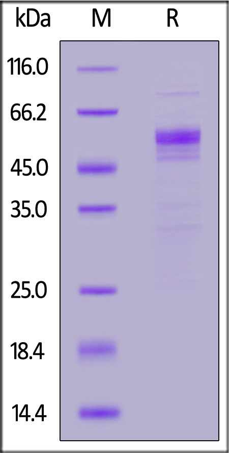 Human USAG-1, Fc Tag (Cat. No. US1-H5254) SDS-PAGE gel