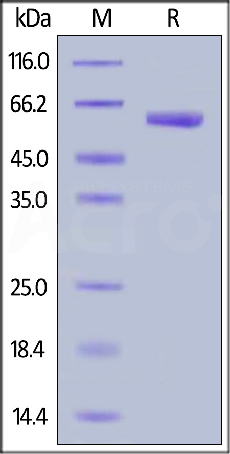 Human VSIG3, Fc Tag (Cat. No. VS3-H5258) SDS-PAGE gel