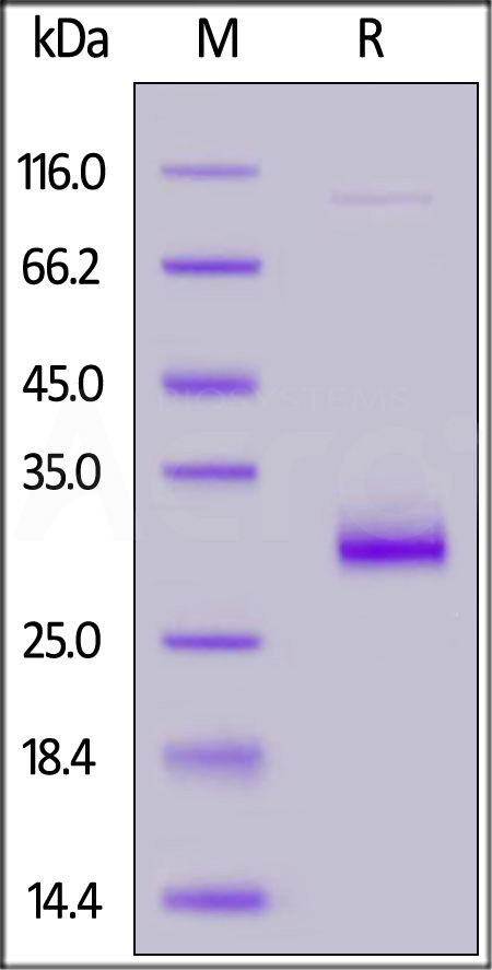 Human VSIG8, His Tag (Cat. No. VS8-H52H1) SDS-PAGE gel