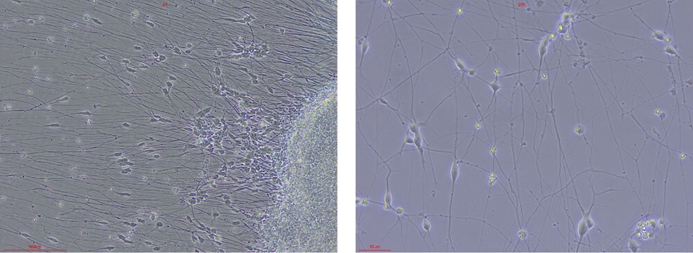  BDNF STEM CELL CULTURE